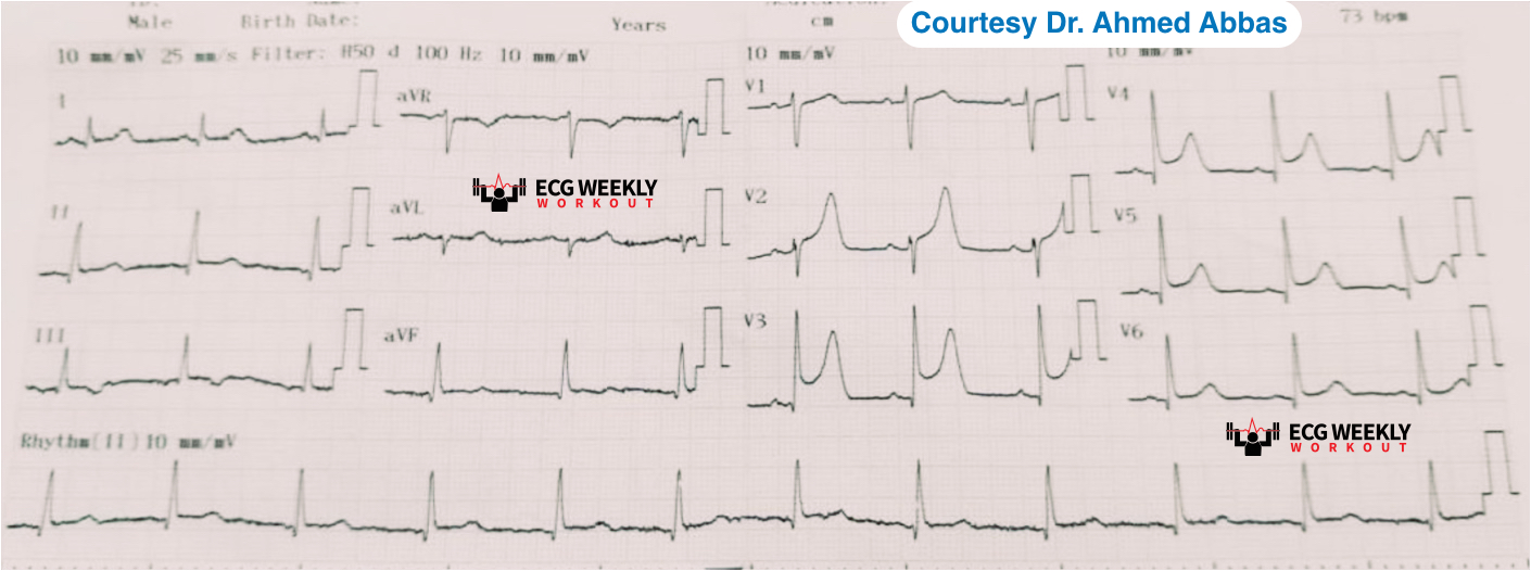 2021-ECG-Case-1