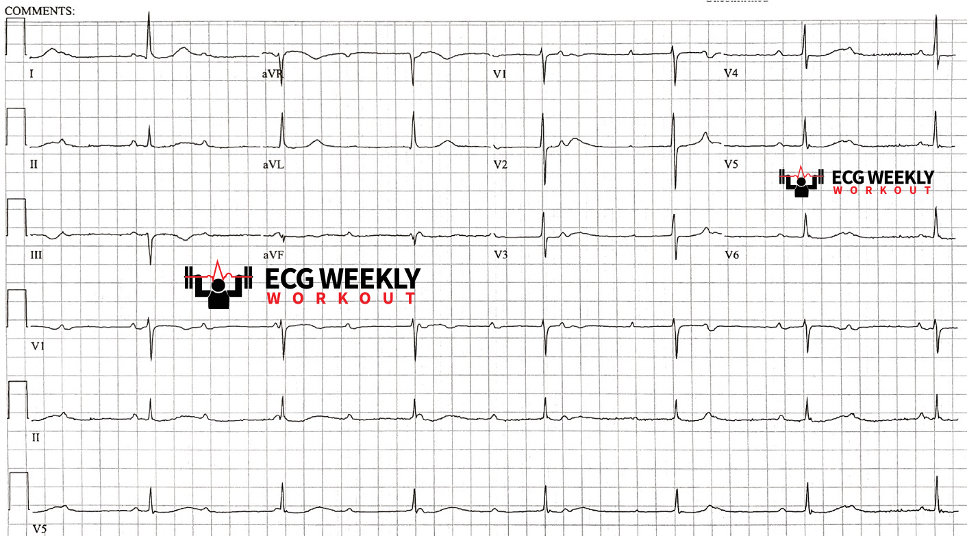 2021-ECG-Case-2