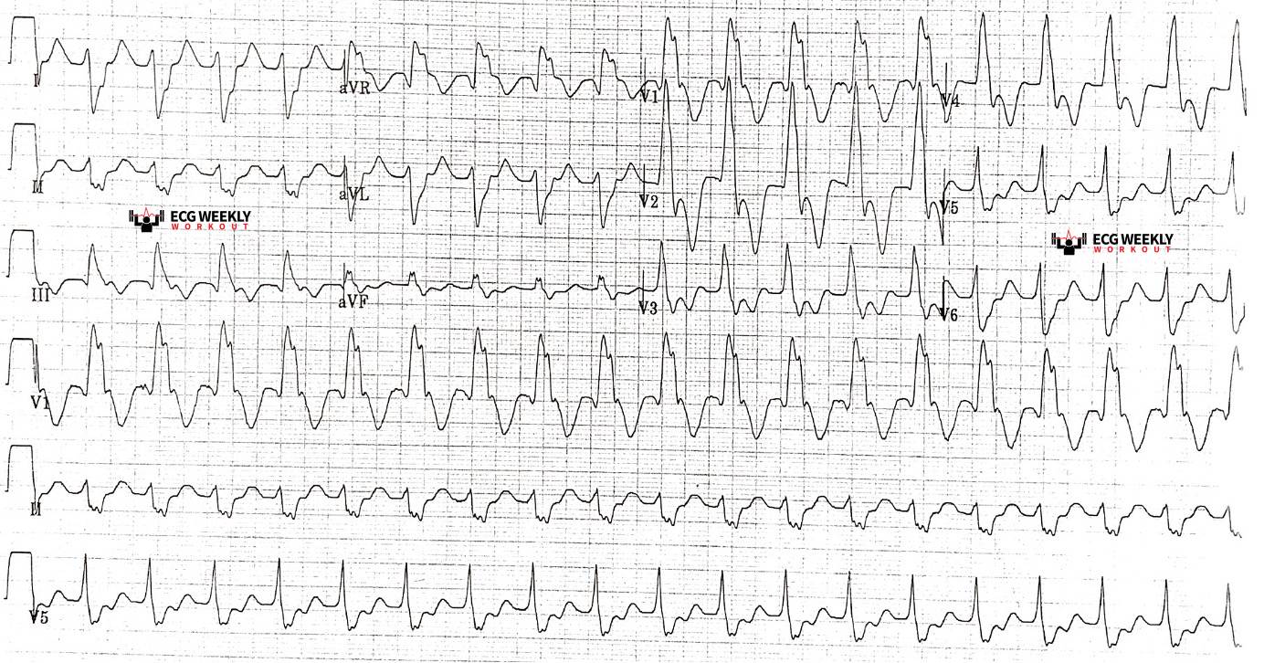2021-ECG-Case-3