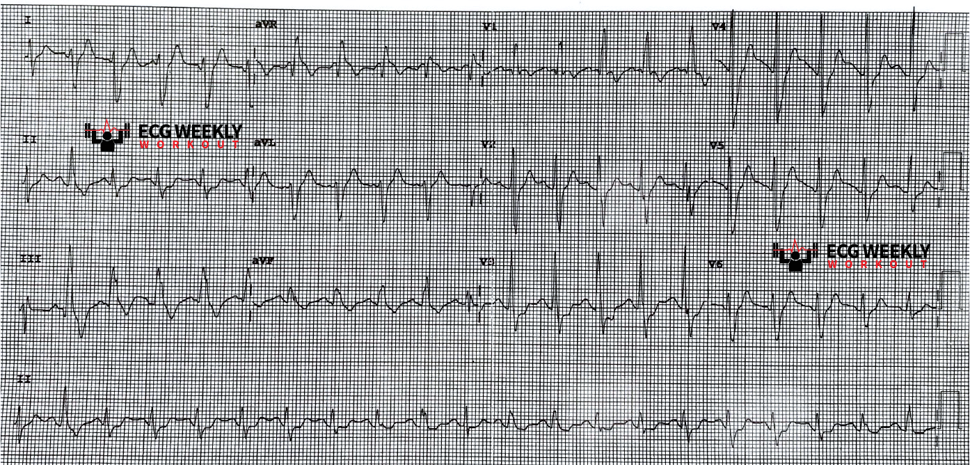 2021-ECG-Case-4