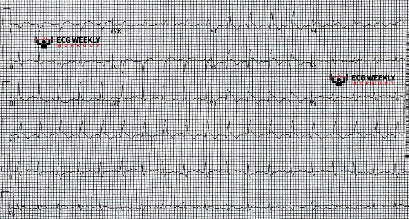 2021-ECG-Case-5