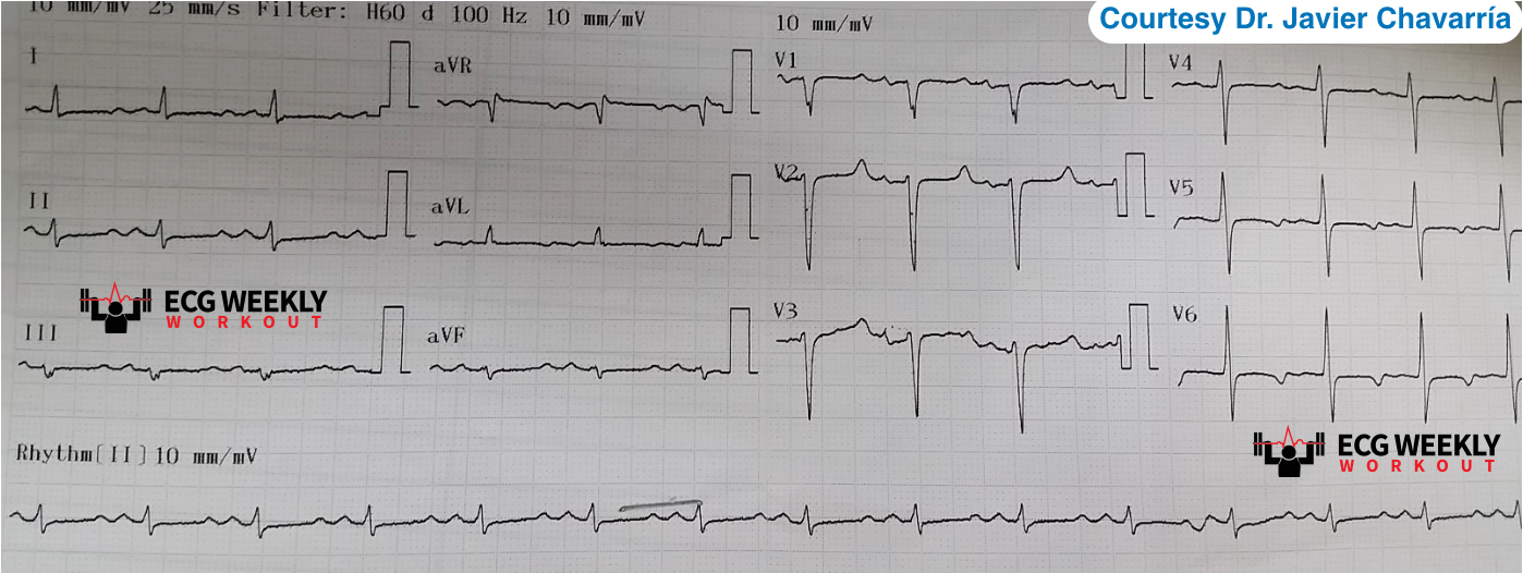 2021-ECG-Case-6