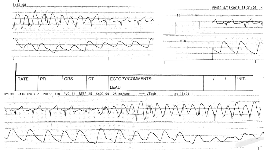 2023 UMEM-ECG-Case-4