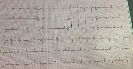 2023 UMEM-ECG-Case-5