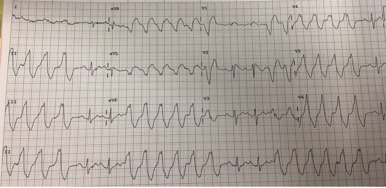 2023 UMEM-ECG-Case-10