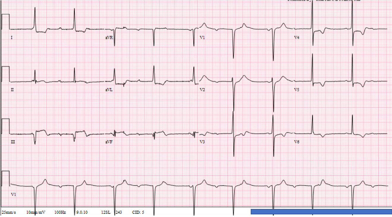 2023 UMEM-ECG-Case-10