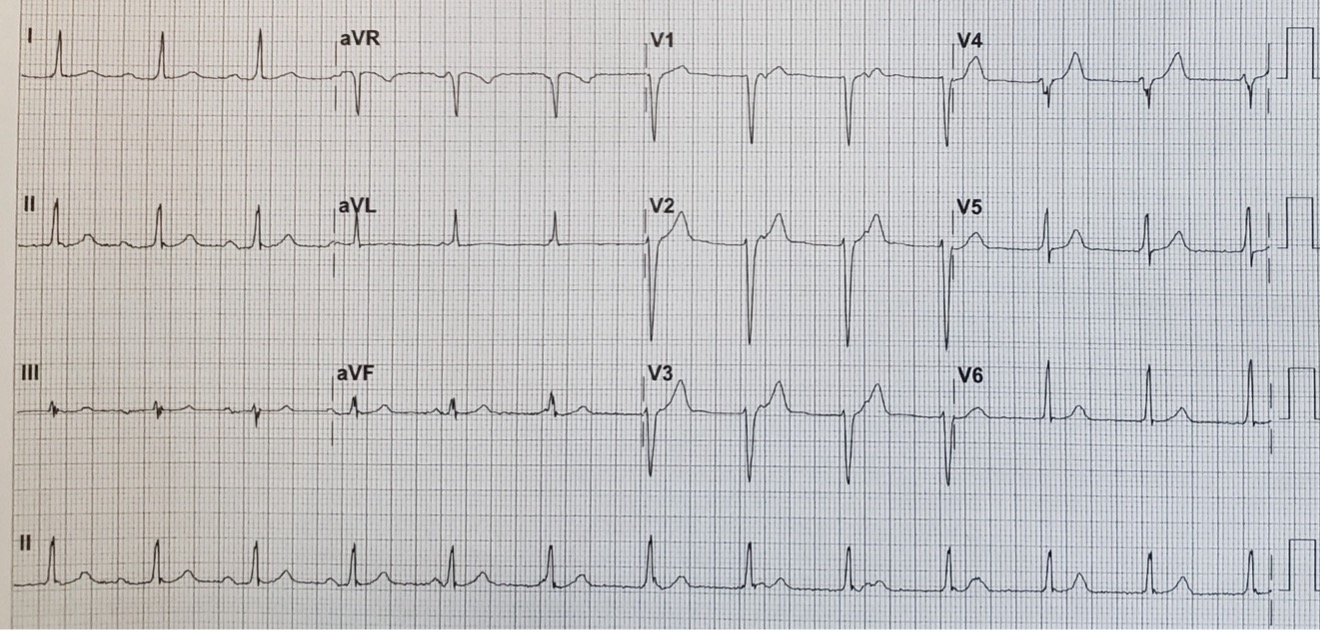 2023 UMEM-ECG-Case-12
