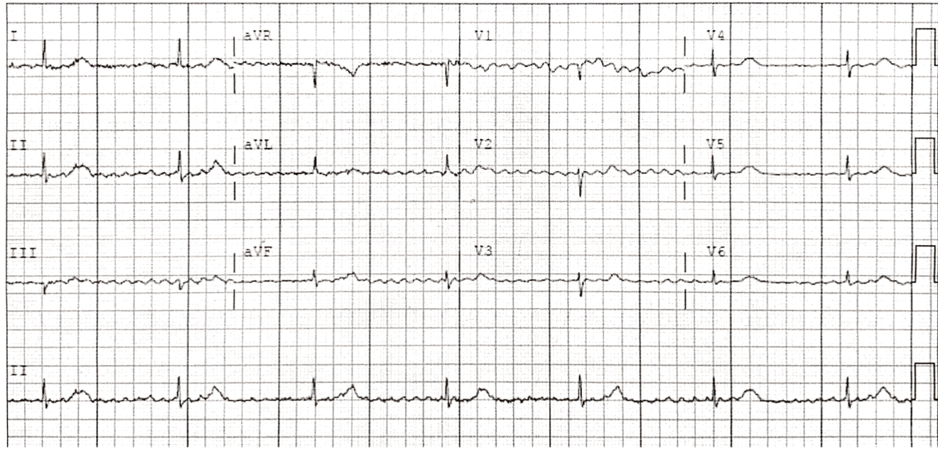 2023 UMEM-ECG-Case-6