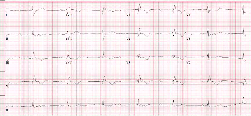 2023 UMEM-ECG-Case-7