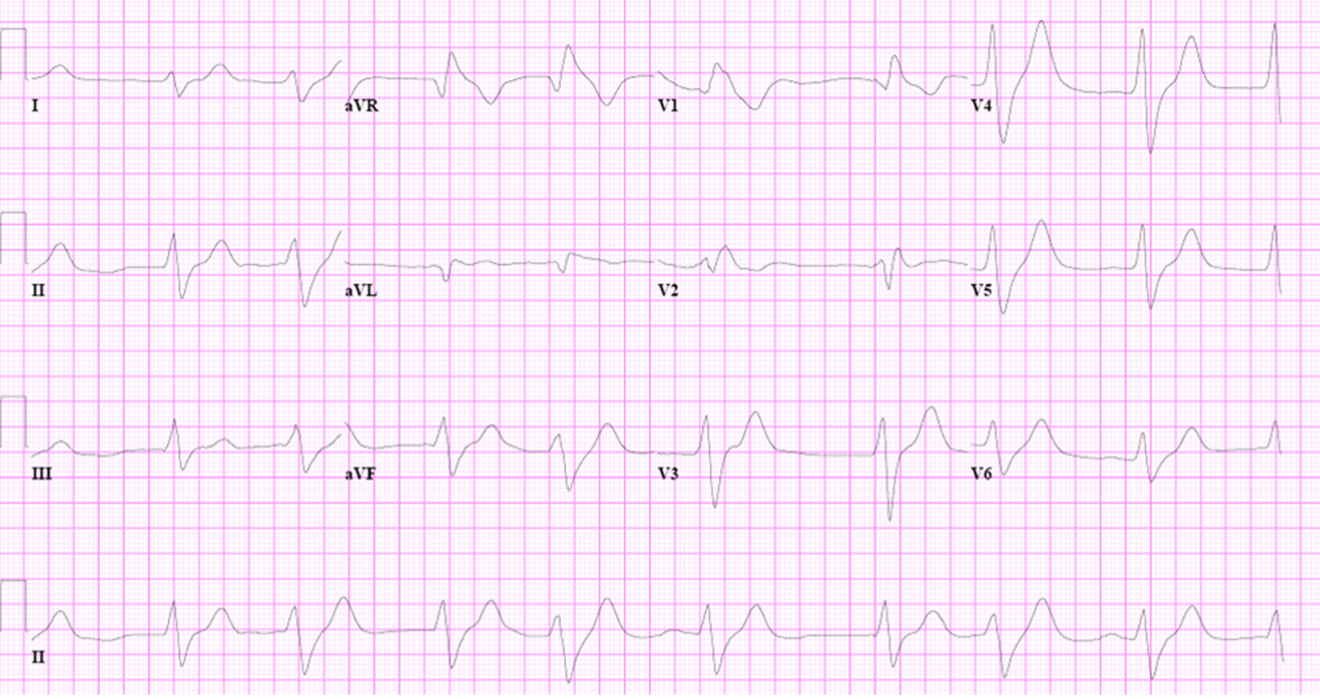 2023 UMEM-ECG-Case-8