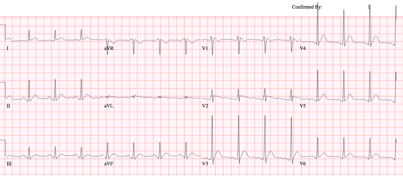 2023 UMEM-ECG-Case-9
