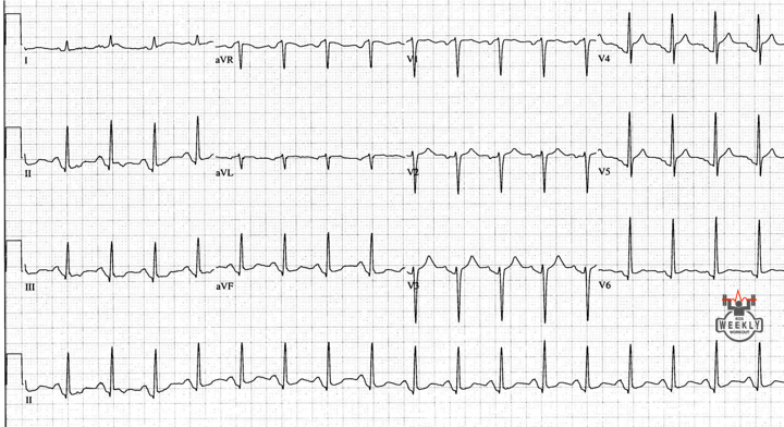 Presenting ECG — ECG Basics & Fundamentals: "just because electrocardiography is a basic skill in medicine, doesn’t mean that our ECG skills should be basic"