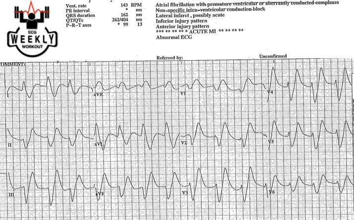 Presenting ECG — Differential Diagnoses: how to use ECG differentials to clinch the diagnosis in sick patients