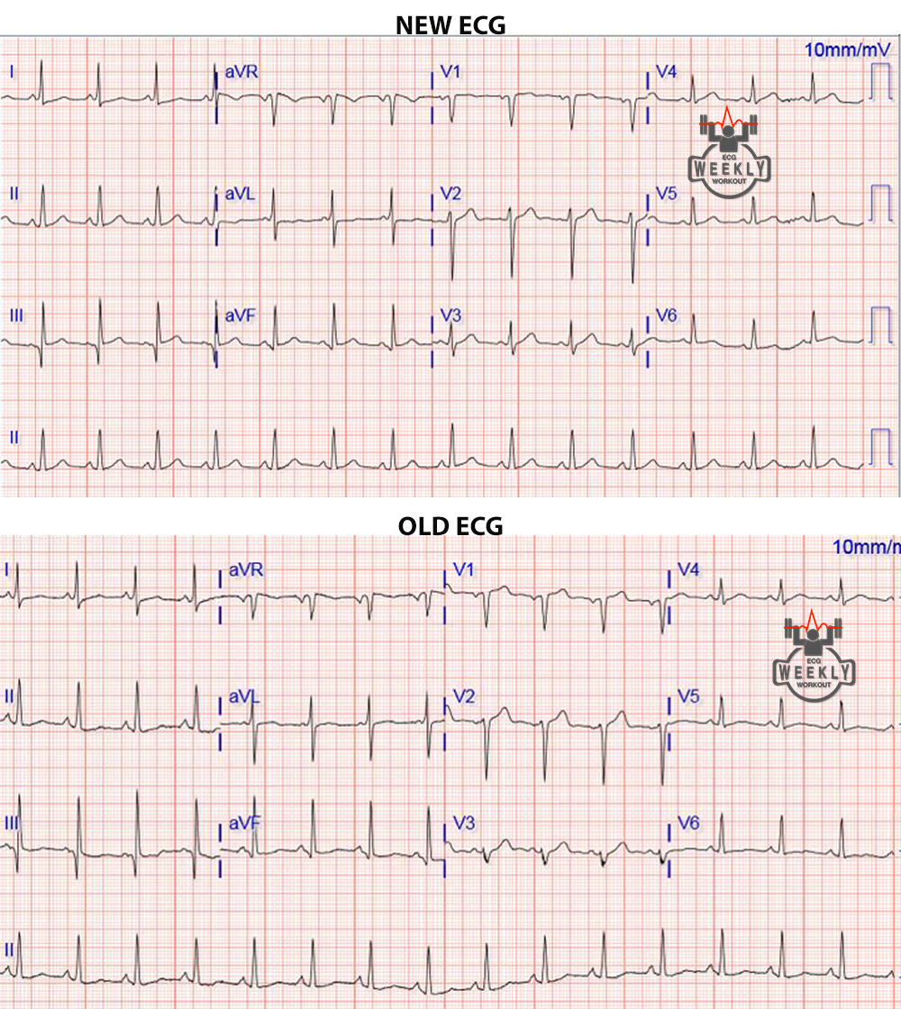 Presenting ECG — STAT ECG Diagnoses: beware the checkmark sign