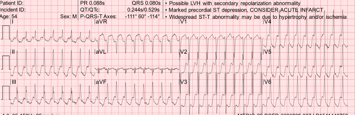 Presenting ECG — Several challenging EMS cases to help you make the diagnosis and save more lives!