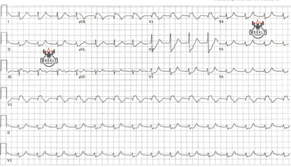 Presenting ECG — Something, that can do anything it wants to the ECG!