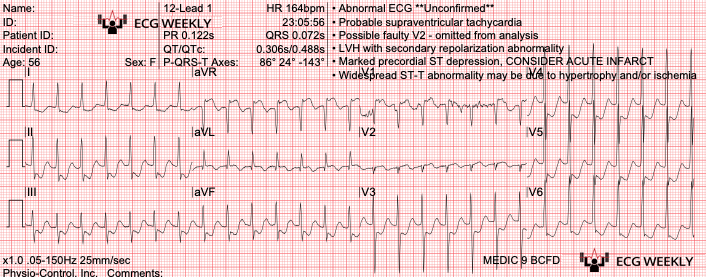 Presenting ECG — 2024 EMS Cases Part II