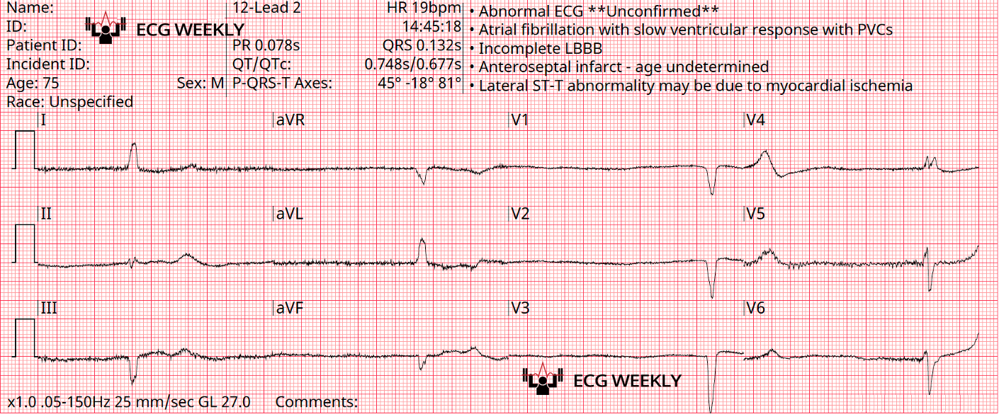Presenting ECG — 2024 EMS Cases Part III