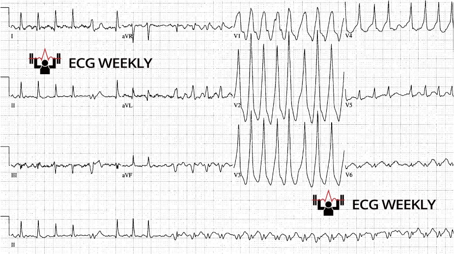 Presenting ECG — 2024 EM Boards ECG Review (Part I/II)