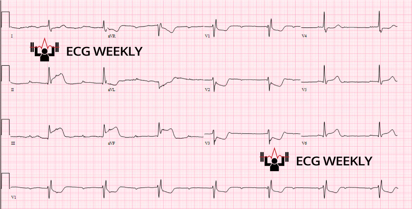 Presenting ECG — Interesting Cases from UMMC (2024 - Part I/III)