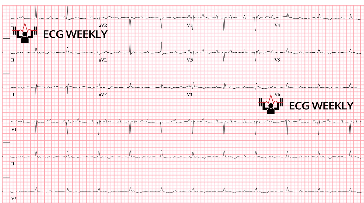 Presenting ECG — Interesting Cases from UMMC (2024 - Part III/III)