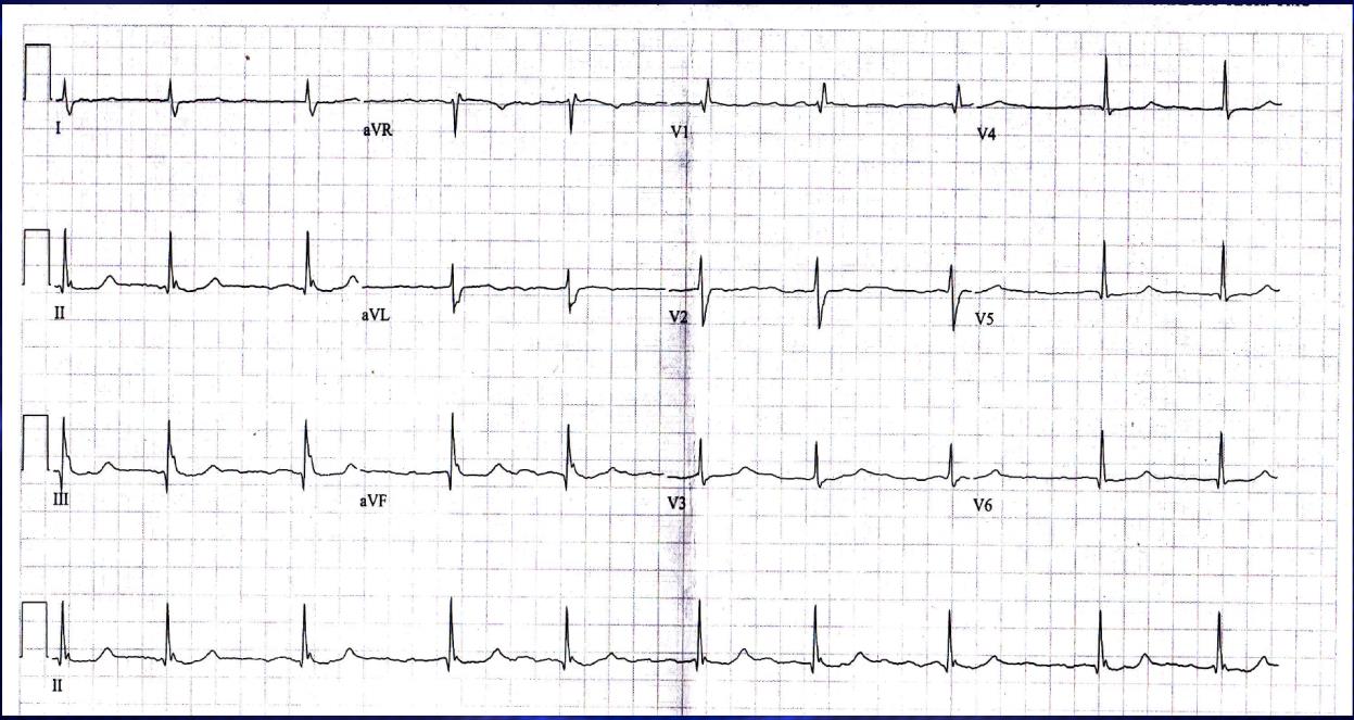 handout 12th annual UMEM ECG comp handout 12th annual UMEM ECG comp