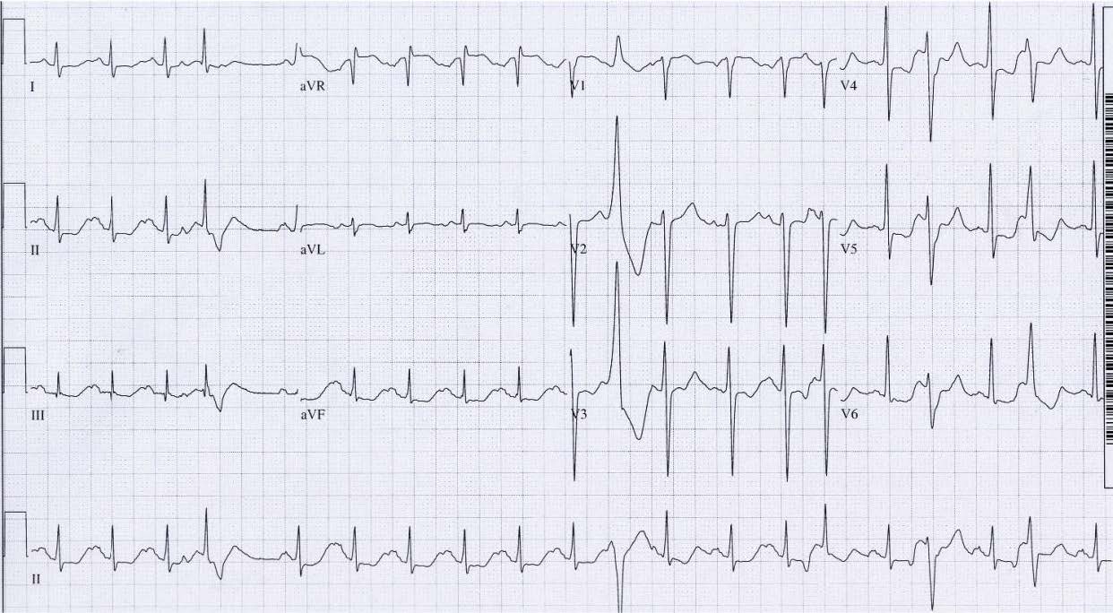 handout 12th annual UMEM ECG comp handout 12th annual UMEM ECG comp