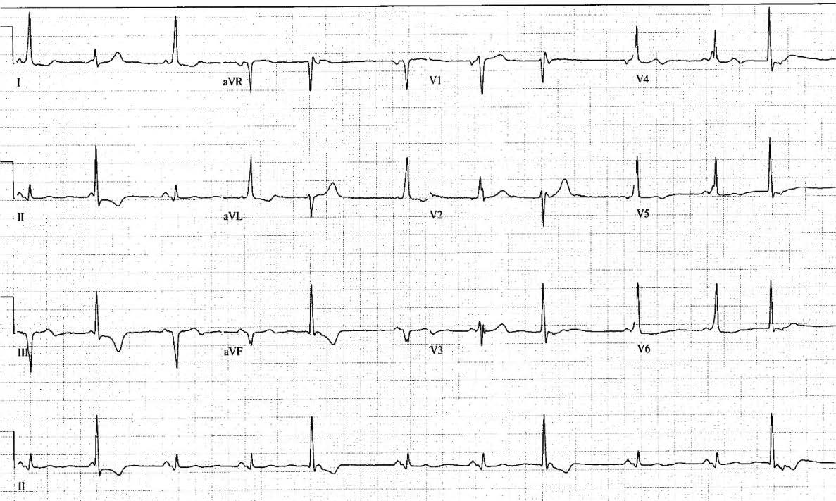 handout 12th annual UMEM ECG comp handout 12th annual UMEM ECG comp