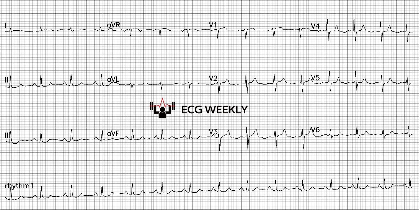 Presenting ECG — A Decade of ECG Gems: Counting Down the Top 10 Cases