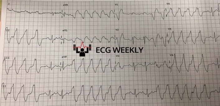 Presenting ECG — A Decade of ECG Gems: The Final 5 Favorite Cases