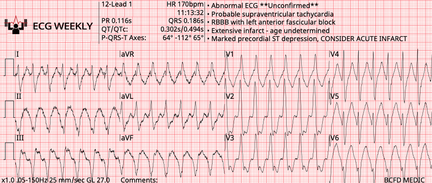 Presenting ECG — 2025 EMS Cases Part III
