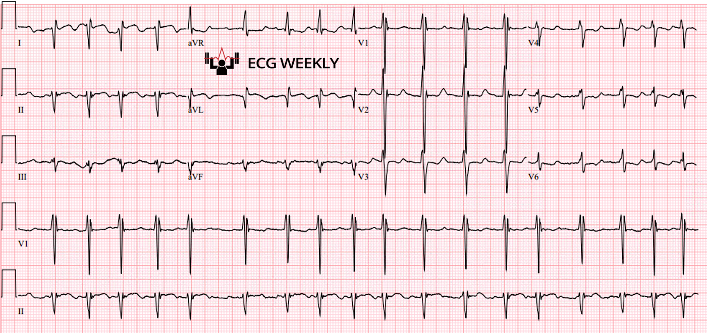 Presenting ECG — Recent University of Maryland Medical Center Cases (Part I)