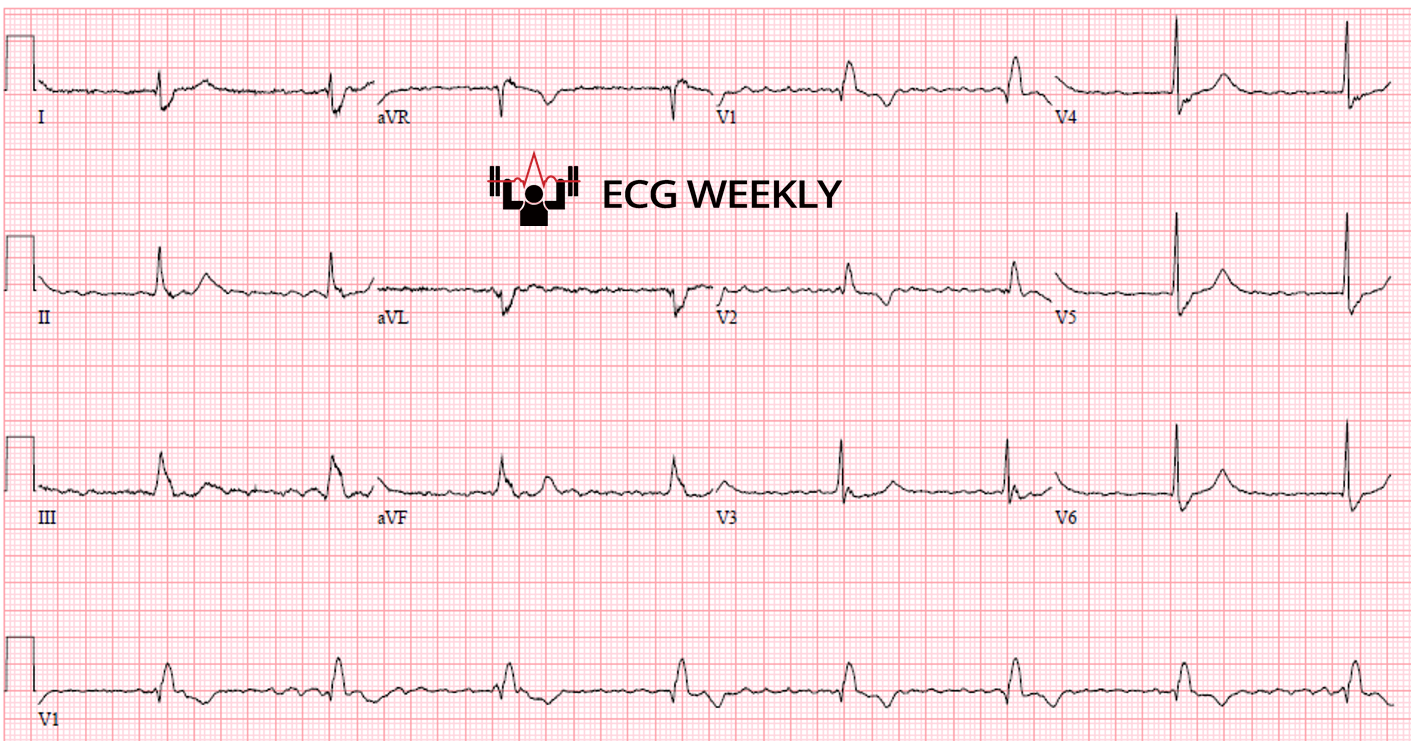 Presenting ECG — Recent University of Maryland Medical Center Cases (Part II)