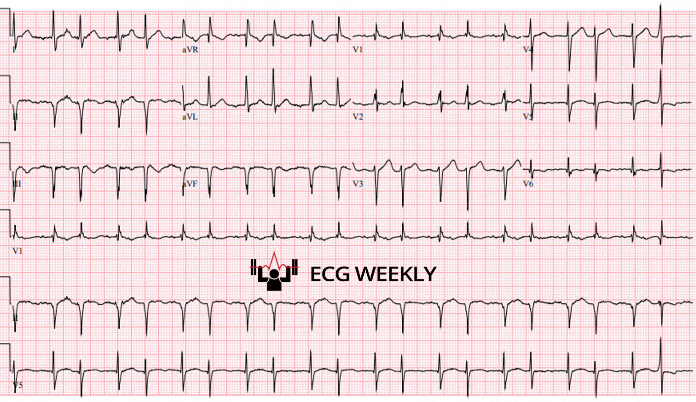 Presenting ECG — Recent University of Maryland Medical Center Cases (Part III)