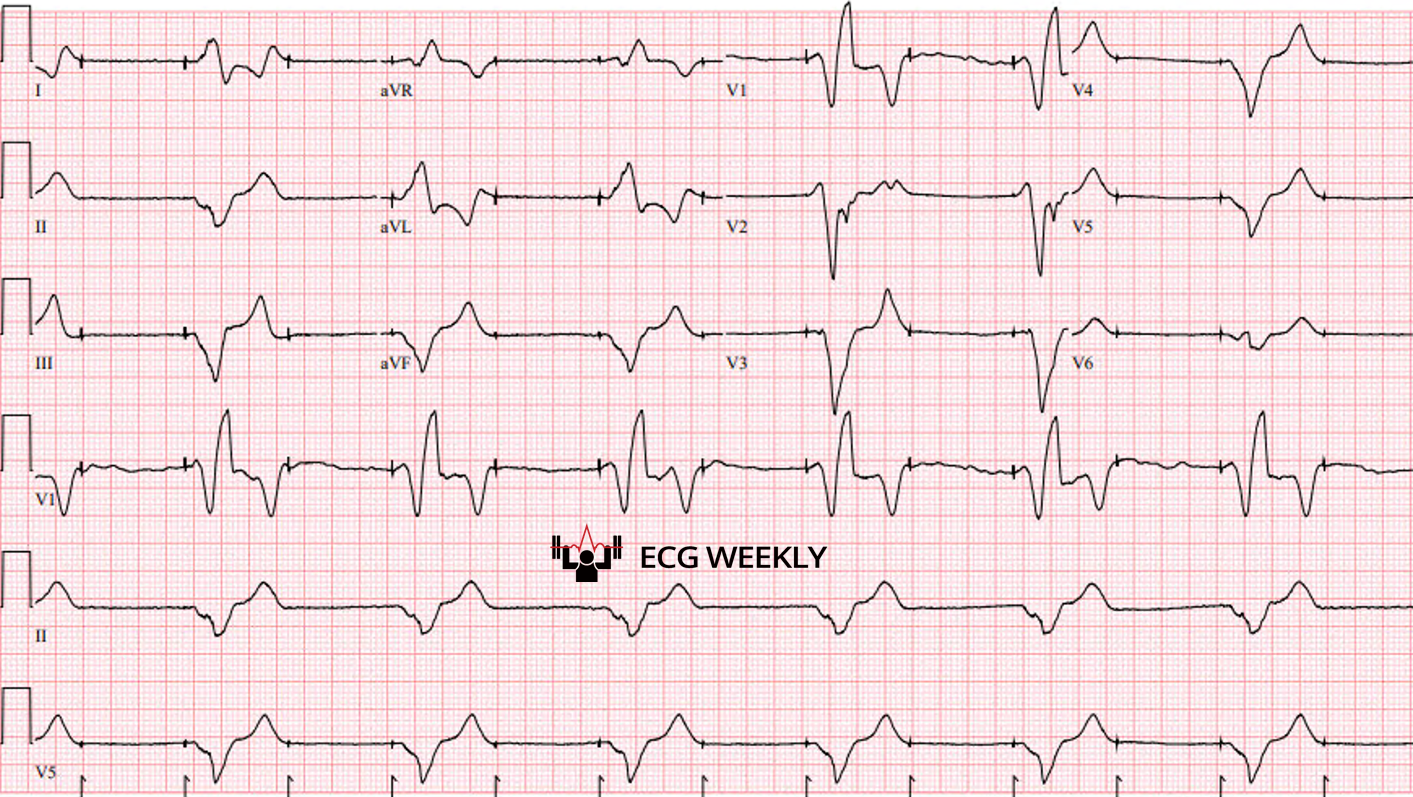 Presenting ECG — Recent University of Maryland Medical Center Cases (Part V)