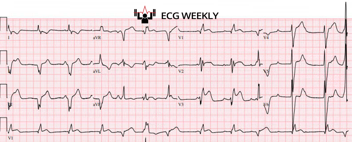 Presenting ECG — Recent ECG Case Highlights from the University of Maryland (Part I)