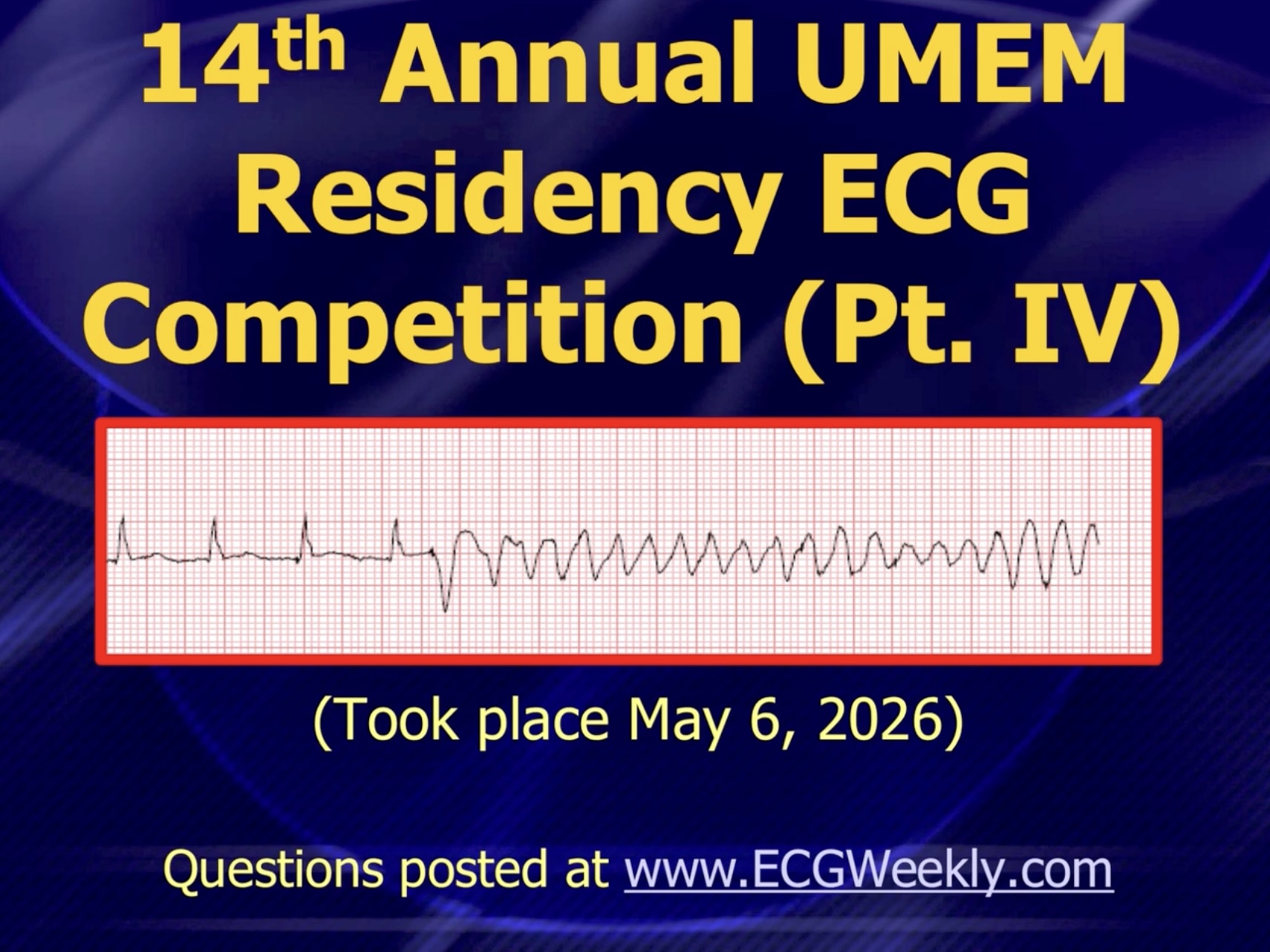 Presenting ECG — 2026 ECG Competition Answers (Part 4)
