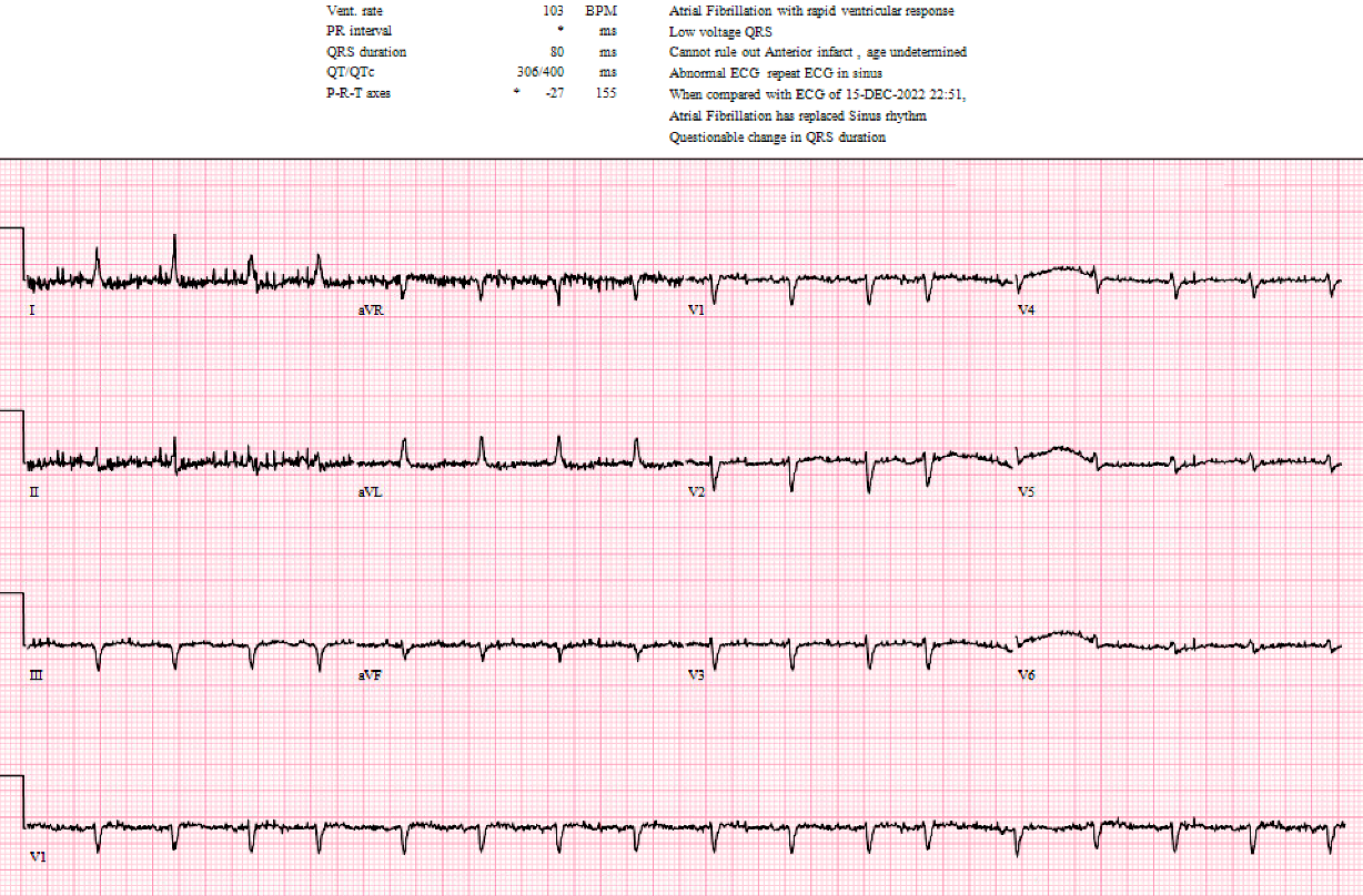 Presenting ECG — The Rhythm Behind the Irregularity
